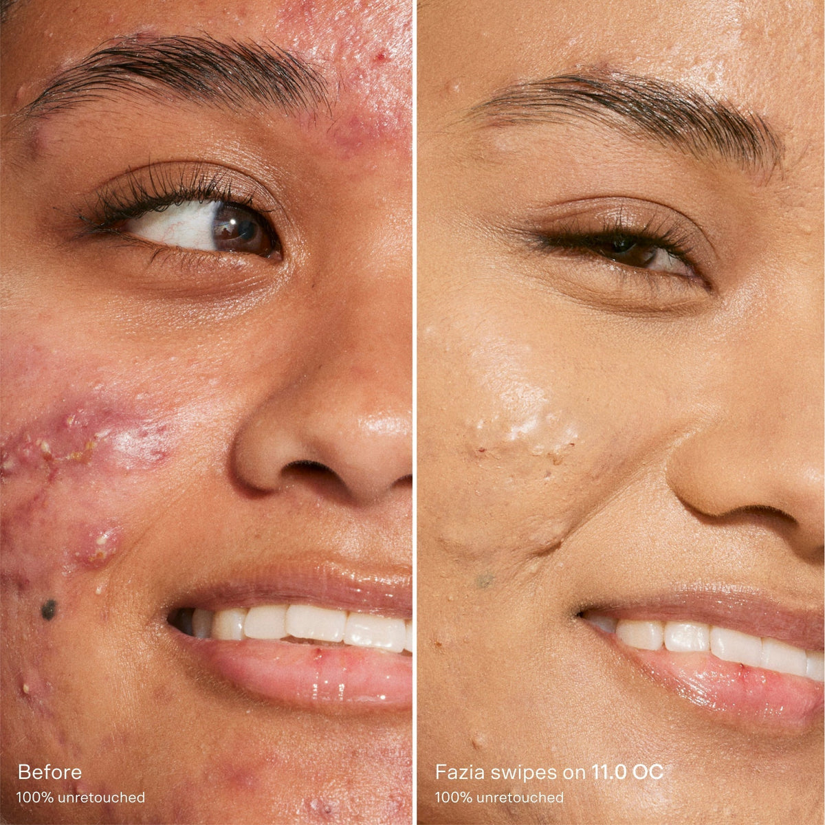 Swipe Serum Concealer® P0