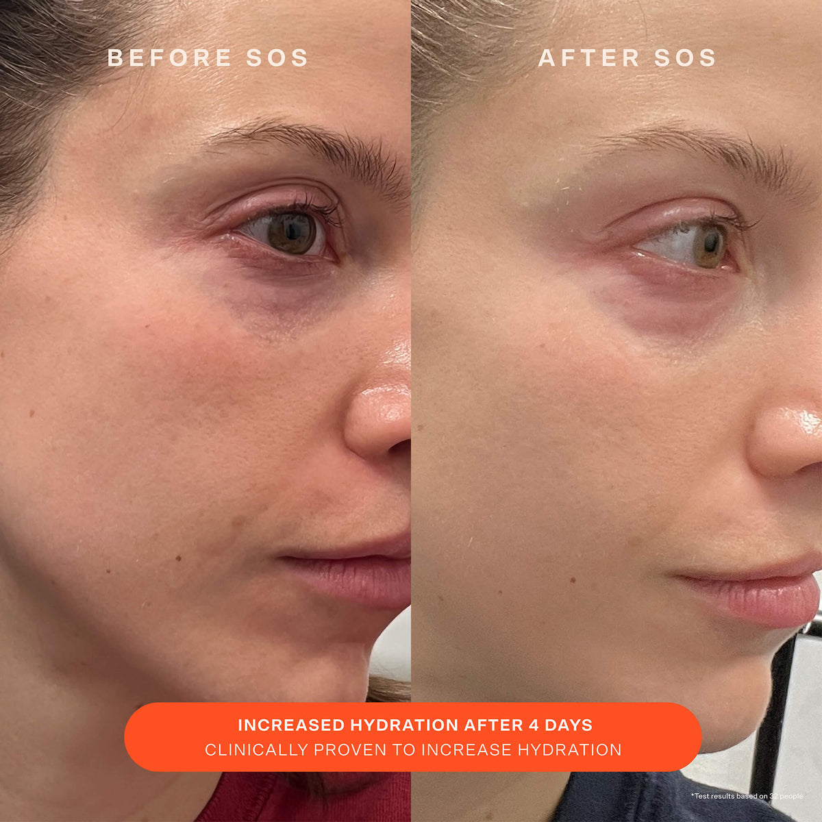 SOS Recovery Cream E5