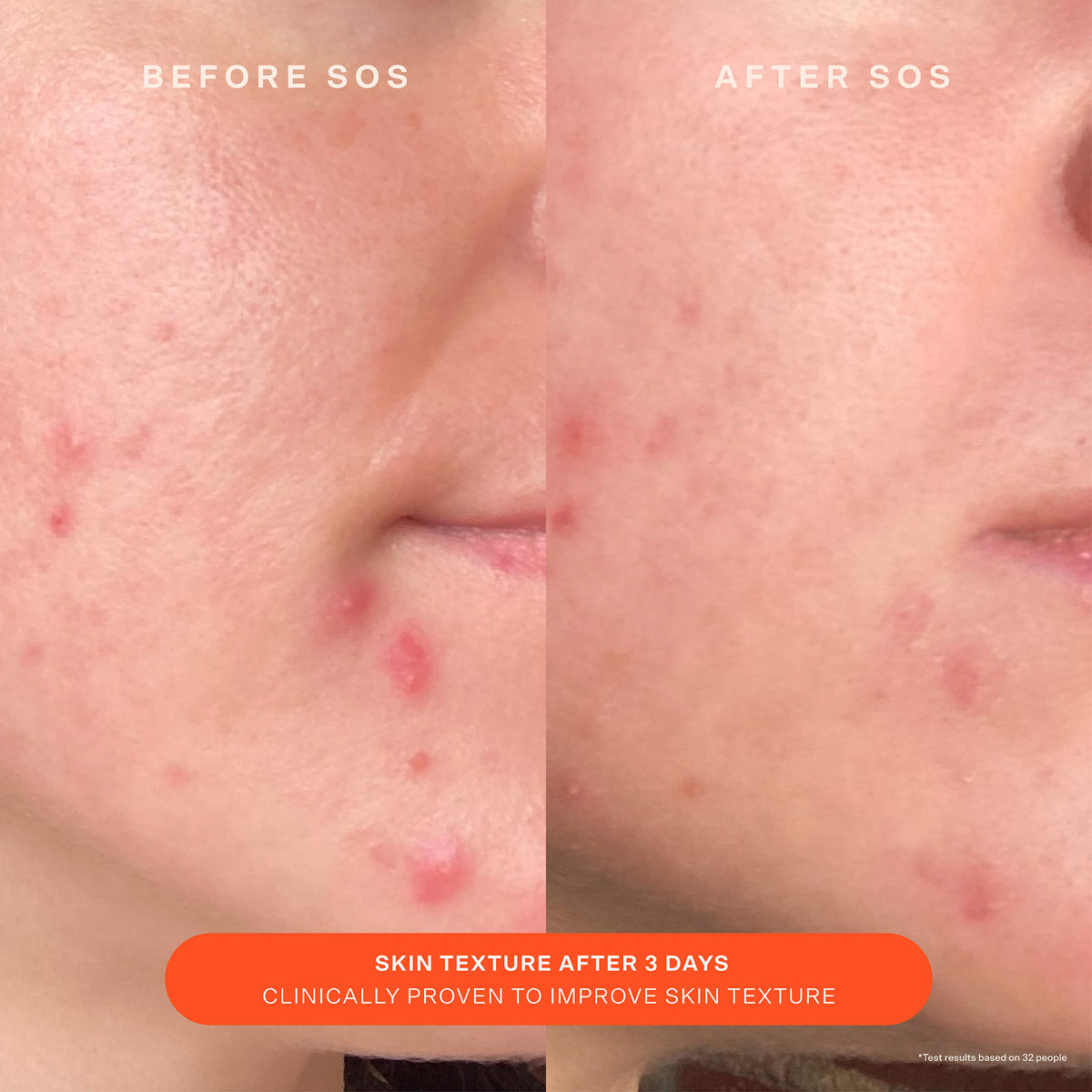 SOS Recovery Cream E5