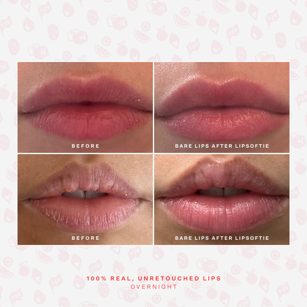 LipSoftie® Lip Treatment Set K5